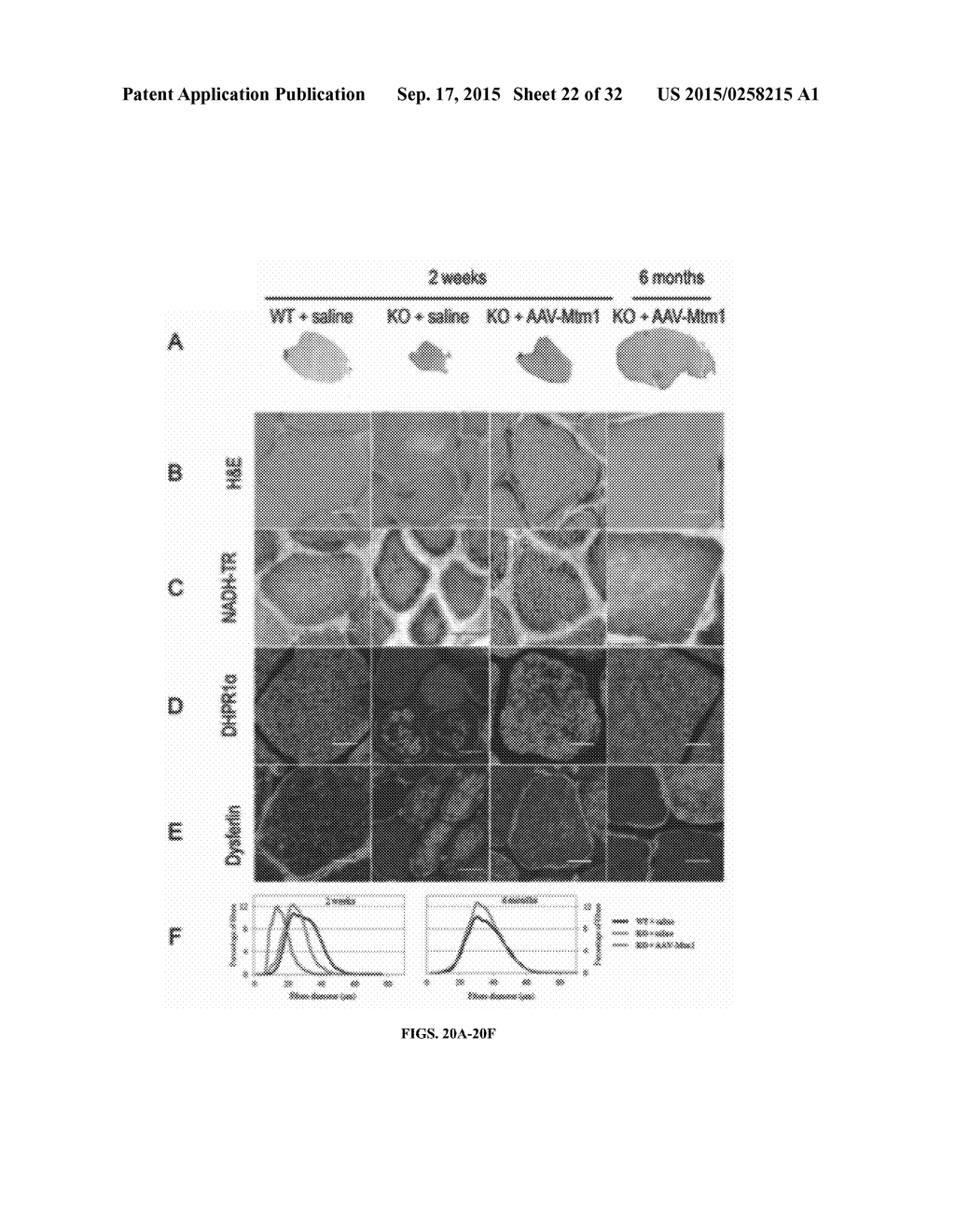 Systemic Gene Replacement Therapy for Treatment of X-Linked MyoTubular     Myopathy (XLMTM) - diagram, schematic, and image 23