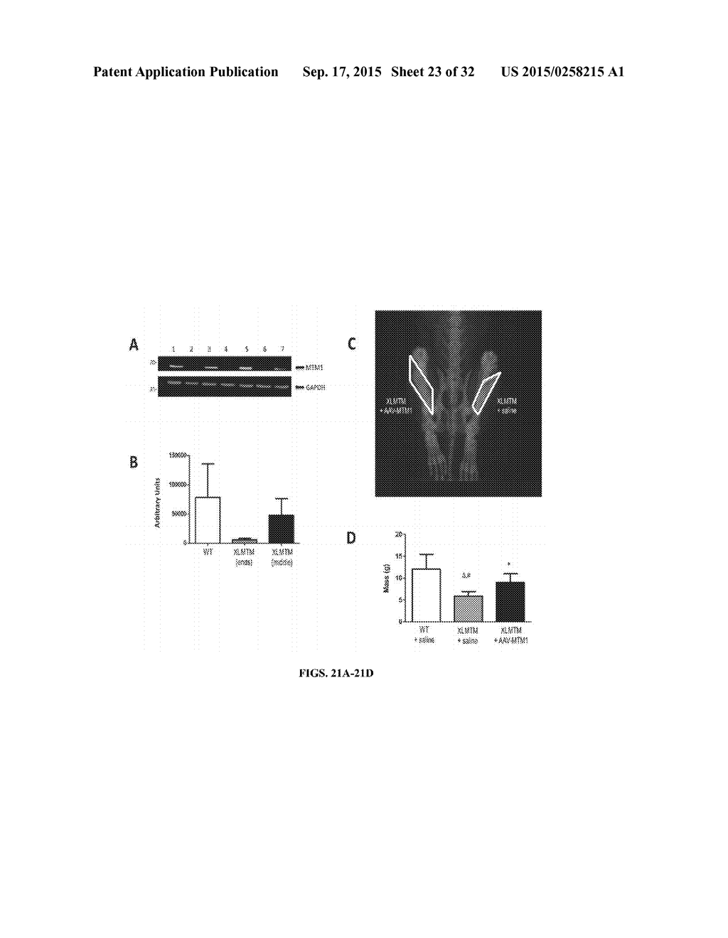 Systemic Gene Replacement Therapy for Treatment of X-Linked MyoTubular     Myopathy (XLMTM) - diagram, schematic, and image 24