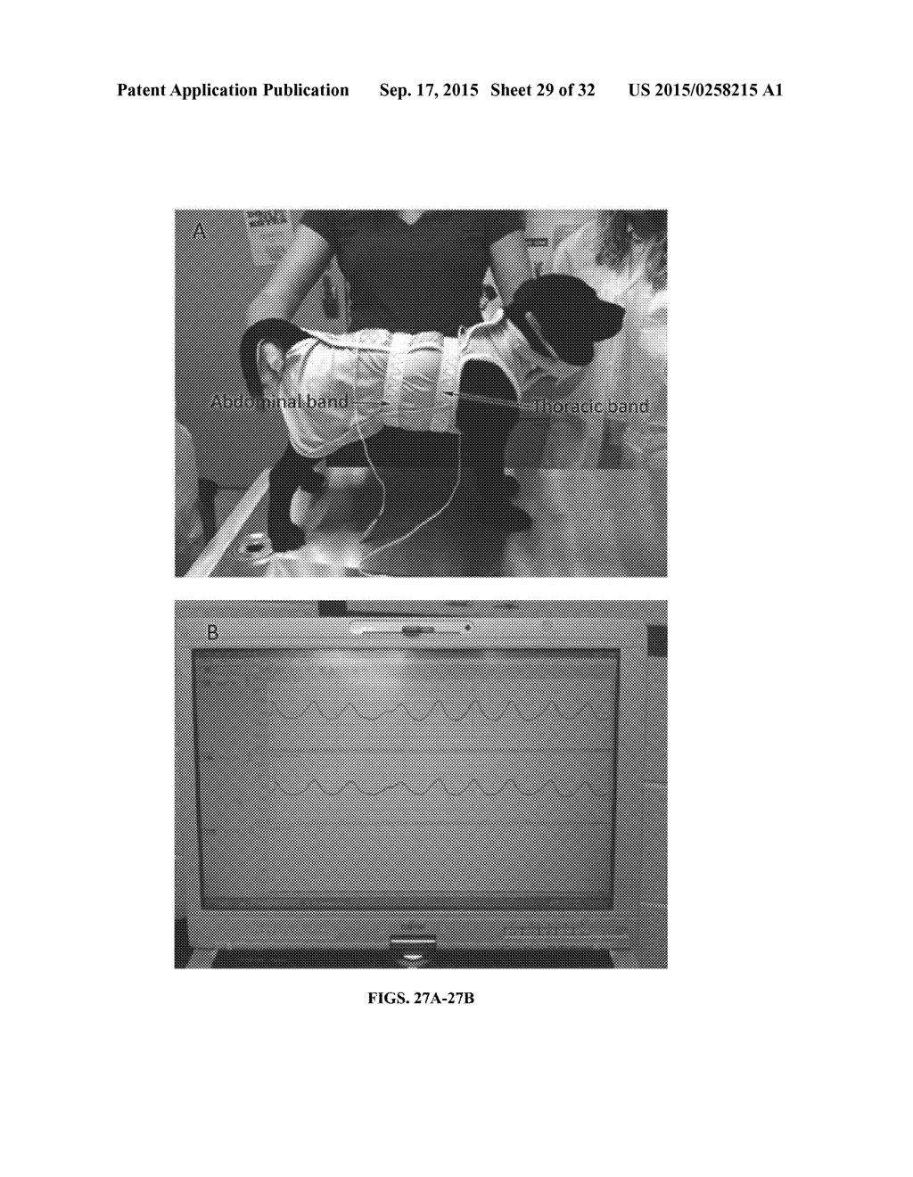 Systemic Gene Replacement Therapy for Treatment of X-Linked MyoTubular     Myopathy (XLMTM) - diagram, schematic, and image 30