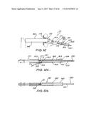 CARTRIDGE FOR AN ELECTRODE ARRAY INSERTION DEVICE diagram and image