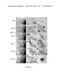 HUMAN ADIPOSE TISSUE WHITE AND  BROWN-ON-WHITE  PROGENITORS FOR     RECONSTRUCTIVE AND METABOLIC THERAPIES diagram and image