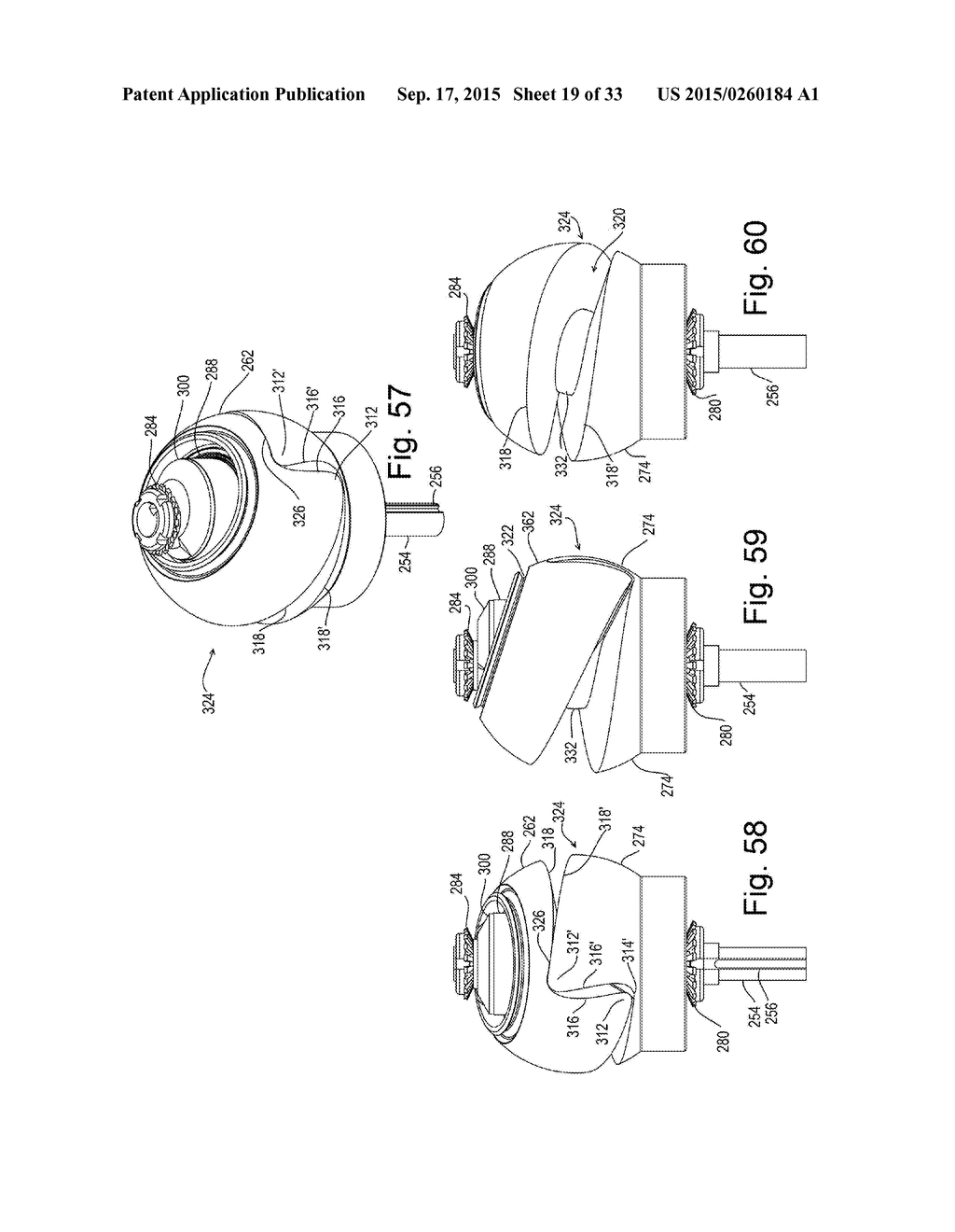 Segmented Positive Displacement Rotor Housing - diagram, schematic, and image 20