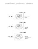 IMAGE INTERPRETATION REPORT CREATING APPARATUS AND IMAGE INTERPRETATION     REPORT CREATING SYSTEM diagram and image