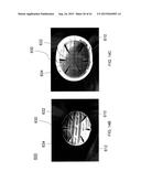 HELMET PADDING SYSTEM diagram and image