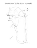 SOLE STRUCTURE FOR BIOMECHANICAL CONTROL diagram and image