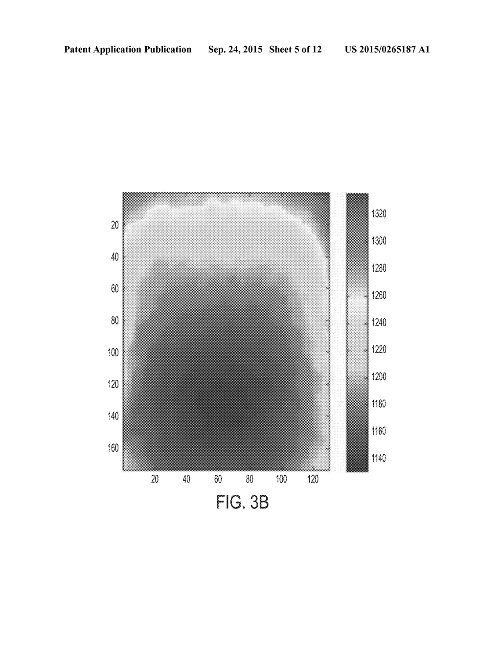 NON-CONTACT MONITORING OF SPATIO-TEMPORAL RESPIRATORY MECHANICS VIA DEPTH     SENSING - diagram, schematic, and image 06