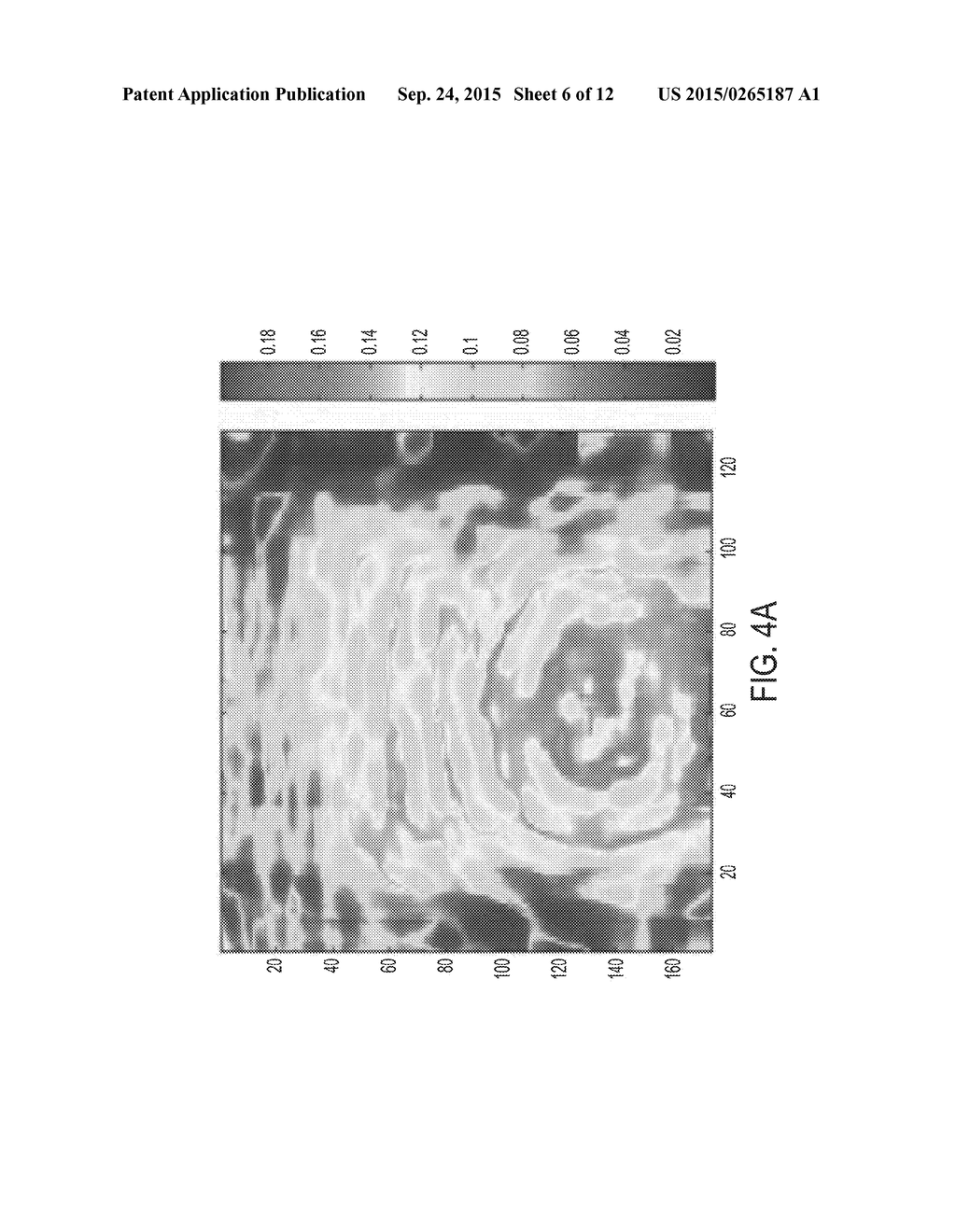 NON-CONTACT MONITORING OF SPATIO-TEMPORAL RESPIRATORY MECHANICS VIA DEPTH     SENSING - diagram, schematic, and image 07