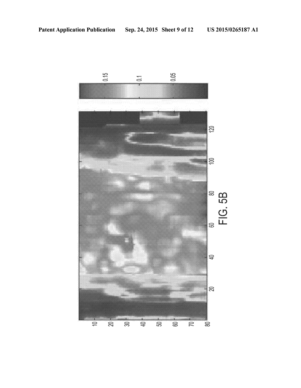 NON-CONTACT MONITORING OF SPATIO-TEMPORAL RESPIRATORY MECHANICS VIA DEPTH     SENSING - diagram, schematic, and image 10