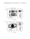 Method and System for Planning Implant Component Position diagram and image