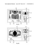 Method and System for Planning Implant Component Position diagram and image