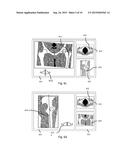 Method and System for Planning Implant Component Position diagram and image