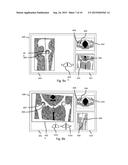 Method and System for Planning Implant Component Position diagram and image