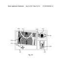 Method and System for Planning Implant Component Position diagram and image