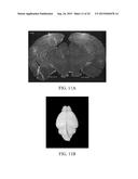 METHODS OF TREATING COGNITIVE IMPAIRMENT diagram and image