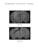 METHODS OF TREATING COGNITIVE IMPAIRMENT diagram and image