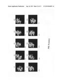 Including fiducial markers in radiation therapy planning to facilitate     real-time position monitoring during treatment delivery diagram and image