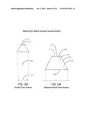 Vessel With Folded Dam diagram and image