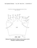 Vessel With Folded Dam diagram and image