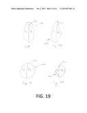 FIBROUS STRUCTURES diagram and image