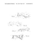 ORTHOPEDIC COMPRESSION PLATE AND METHOD OF SURGERY diagram and image