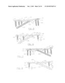 ORTHOPEDIC COMPRESSION PLATE AND METHOD OF SURGERY diagram and image