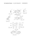 ORTHOPEDIC COMPRESSION PLATE AND METHOD OF SURGERY diagram and image