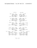 ORTHOPEDIC COMPRESSION PLATE AND METHOD OF SURGERY diagram and image