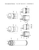 METHOD AND APPARATUS FOR DELIVERING CEMENT PASTE INTO A BONE CAVITY diagram and image