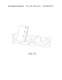 HOLLOW BODY CAVITY ABLATION APPARATUS diagram and image