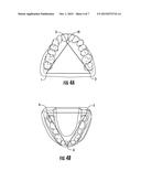 THREE-DIMENSIONAL BODY diagram and image