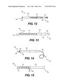 DEVICES FOR FORMING COLLATERAL CHANNELS AND RELATED METHODS OF USE diagram and image