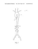 AORTIC VALVE POSITIONING SYSTEMS, DEVICES, AND METHODS diagram and image