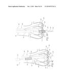 AORTIC VALVE POSITIONING SYSTEMS, DEVICES, AND METHODS diagram and image