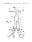 Sealable Endovascular Implants and Methods for Their Use diagram and image