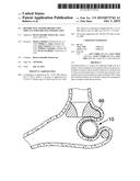 RESTRICTIVE AND/OR OBSTRUCTIVE IMPLANT FOR INDUCING WEIGHT LOSS diagram and image