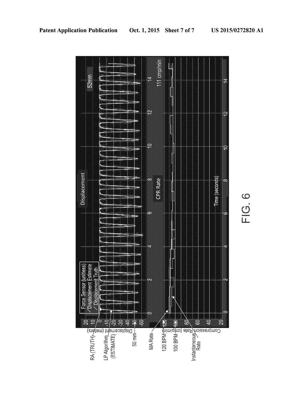 CARDIOPULMONARY RESUSCITATION (CPR) FEEDBACK SYSTEMS AND METHODS - diagram, schematic, and image 08