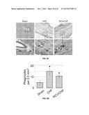 RETROGRADE CORONARY VEIN DELIVERY OF STEM CELLS diagram and image