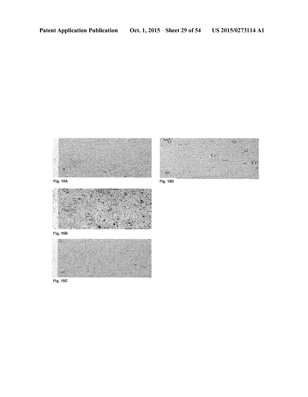 CROSSLINKED PEPTIDE HYDROGELS - diagram, schematic, and image 30