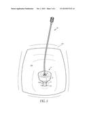 BOWED TIP FOR LAPAROSCOPIC SURGERY diagram and image