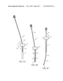 BOWED TIP FOR LAPAROSCOPIC SURGERY diagram and image