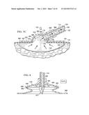 Systems and Methods for Treating a Tissue Site with Reduced Pressure     Involving a Reduced-Pressure Interface Having a Multi-Lumen Conduit for     Contacting a Manifold diagram and image