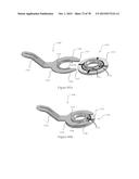 Ventricular Cuff diagram and image