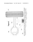 Vehicle-mounted Traction Apparatus diagram and image