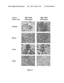 Antibodies Reactive with B7-H3, Immunologically Active Fragments Thereof     and Uses Thereof diagram and image