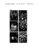 NEURAL STEM CELL HAVING INCREASED PASSAGE ABILITY, METHOD FOR     MANUFACTURING NEURAL STEM CELL HAVING SAID INCREASED PASSAGE ABIILITY,     AND METHOD FOR CULTURING NEURAL STEM CELLS FOR INCREASING PASSAGE ABILITY     OF NEURAL STEM CELLS diagram and image