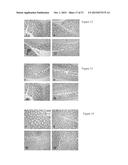 THERAPEUTIC APOPTOTIC CELL PREPARATIONS, METHOD FOR PRODUCING SAME AND     USES THEREOF diagram and image