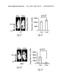 TREATMENT OF METASTATIC BREAST CANCER diagram and image