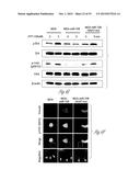 TREATMENT OF METASTATIC BREAST CANCER diagram and image