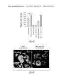 TREATMENT OF METASTATIC BREAST CANCER diagram and image