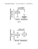 TREATMENT OF METASTATIC BREAST CANCER diagram and image